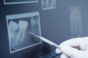 Dental Care